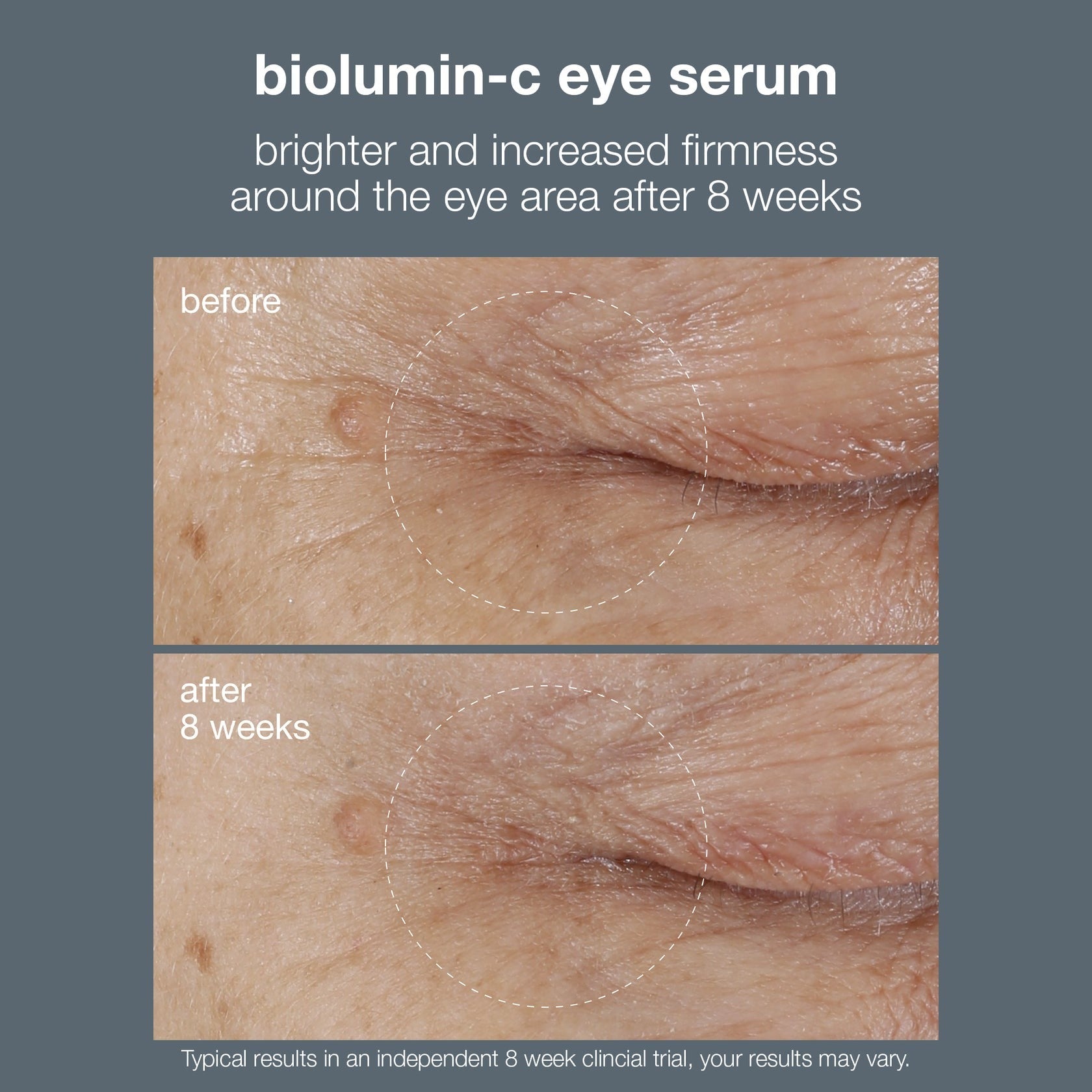 Dermalogica - Biolumin-C Vitamin C Eye Serum (15ml)