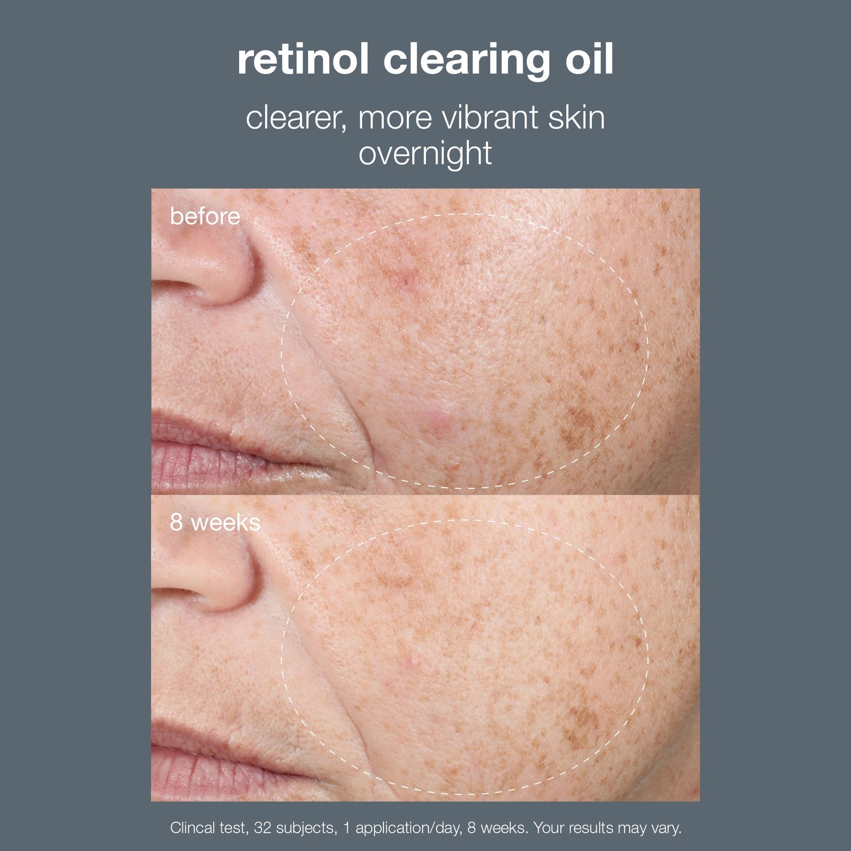 Dermalogica - Active Clearing - Retinol Clearing Oil (30ml)